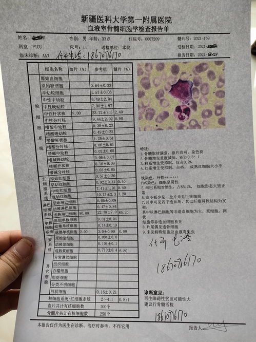 亲子鉴定血型对照表（亲子鉴定血型对照表202031017万阅读）