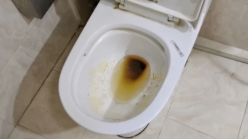 梦见厕所很脏全是屎（女人梦见茅坑好多屎无处下脚）