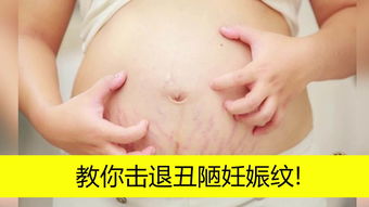 妊娠纹是怎么形成的（肚子上的妊娠纹是怎么形成的）